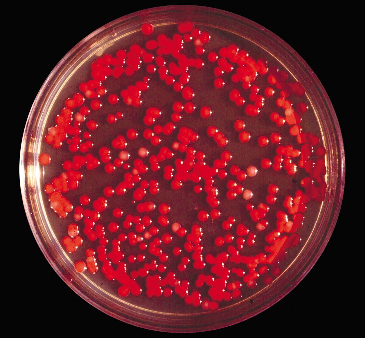 Serratia marcescens